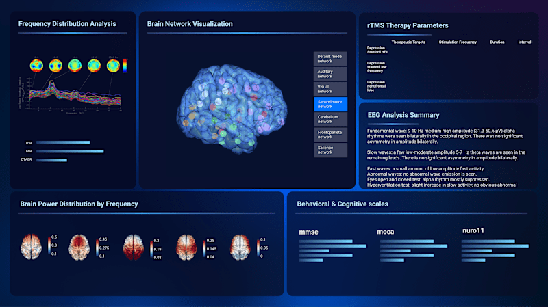 Cover image for TMS Brain Dashboard for National Training