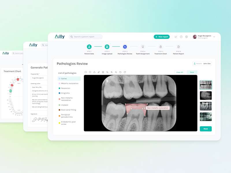 Cover image for AI dentistry SaaS | Product design