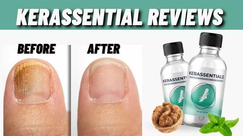 Cover image for Kerassentials Reviews (BE APPROVEN) It Scam Or Trusted!