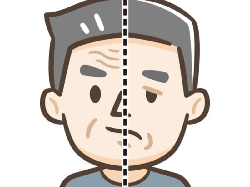 Cover image for Stroke signs and symptoms - MosiPhysio