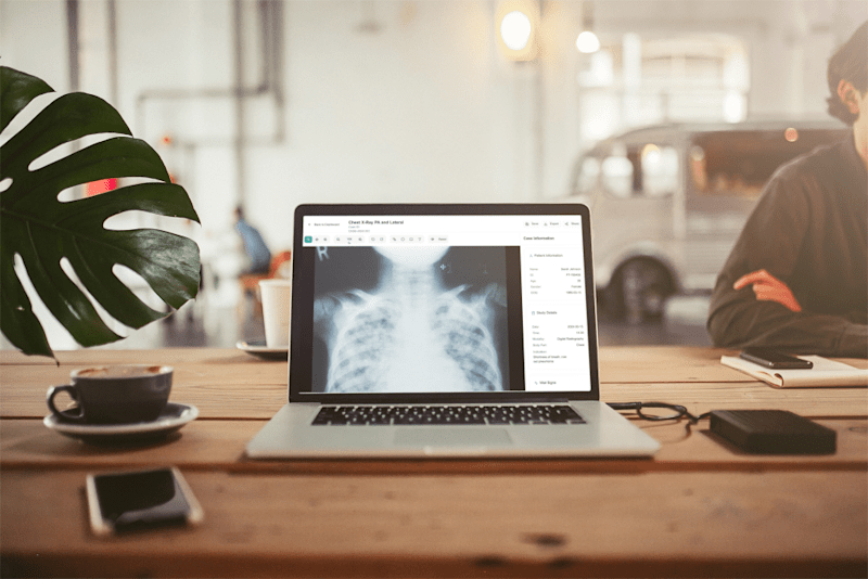 Cover image for Medical Imaging Annotation Platform Design
