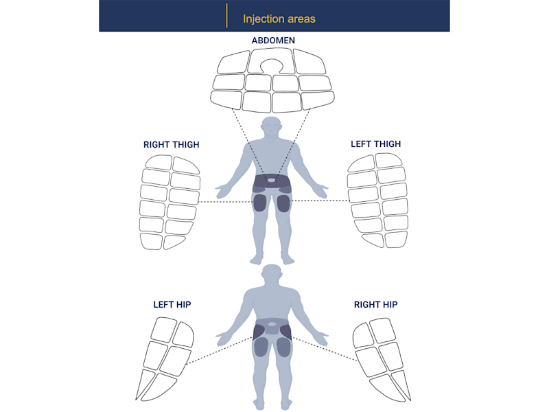 Cover image for An illustration of injection areas