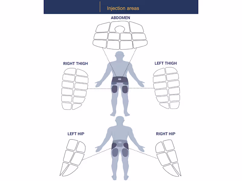 Cover image for An illustration of injection areas