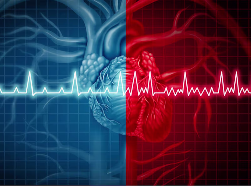 Cover image for Silent Myocardial Infarction in Diabetic Elderly Patient-