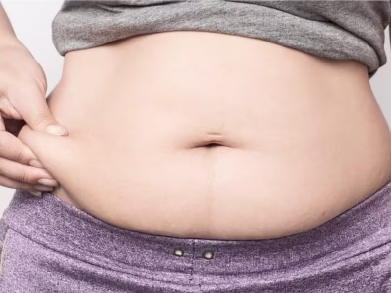 Cover image for Your ‘mummy tummy’ Is a Big Problem…