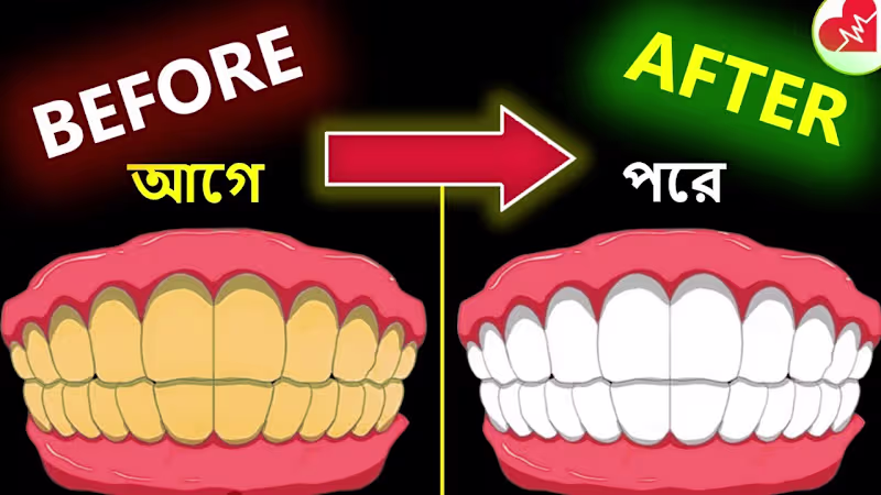 Cover image for Make Yellow Teeth Sparkle Pearly White at Home (Easy)