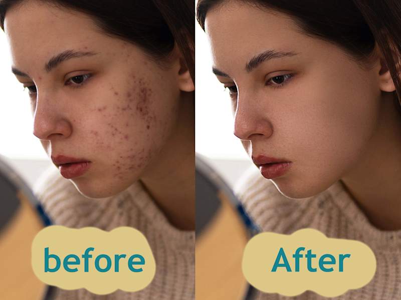 Cover image for photo edit, Retouching & Enhancement, background/object removal.