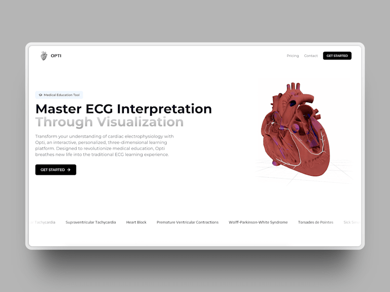 Cover image for Opti - 3D ECG Visualization Education Tool