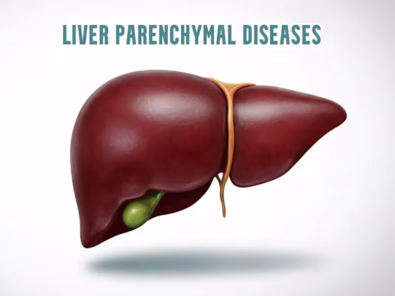 Cover image for Comprehensive Guide on Hepatic Parenchymal Disease