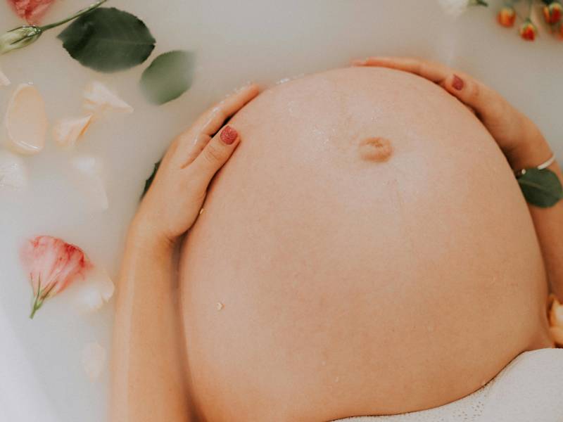 Cover image for The 3 Things You Should Do For Minimum Stretch Marks