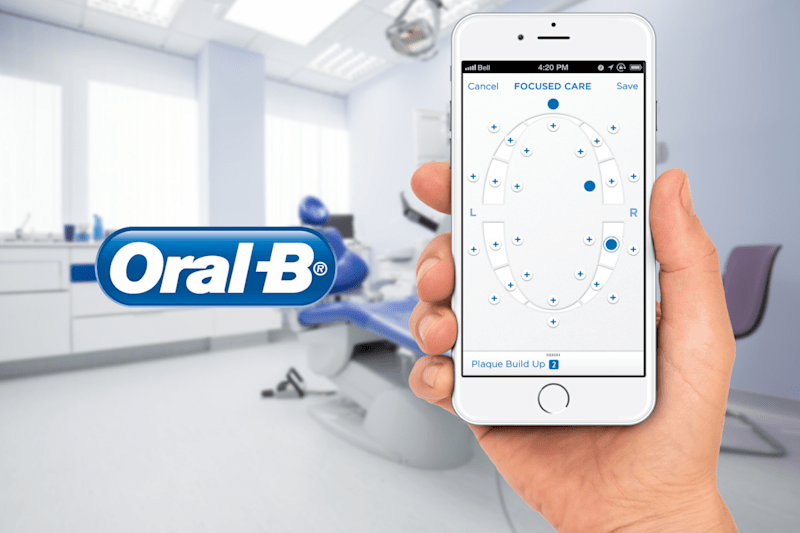 Cover image for Oral-B iOS App to Sync with the Power Toothbrush