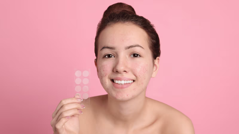 Cover image for 5 Reasons You Still Have Pesky Persistent Acne