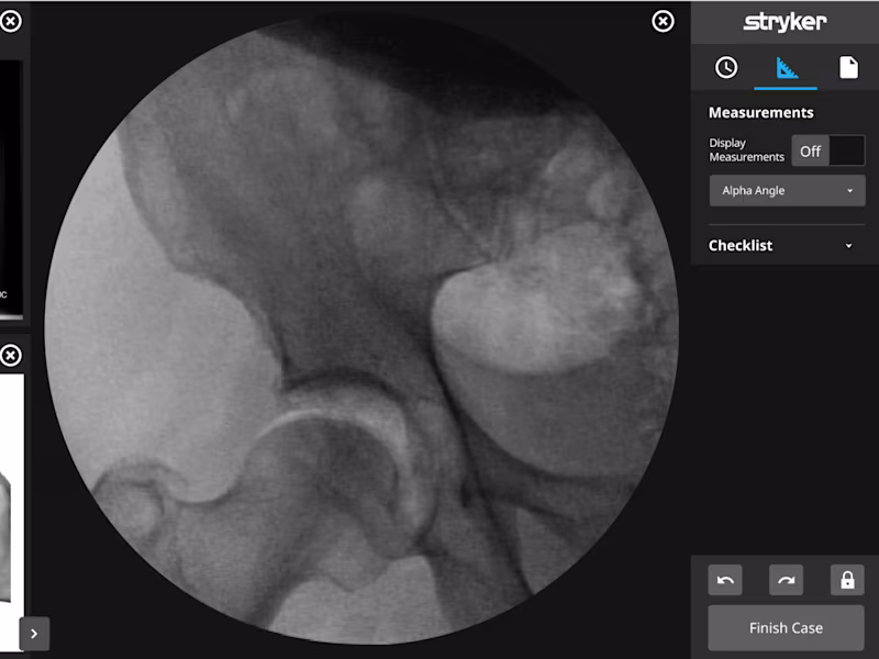 Cover image for Prototyping Cutting-Edge Medical Devices for Stryker