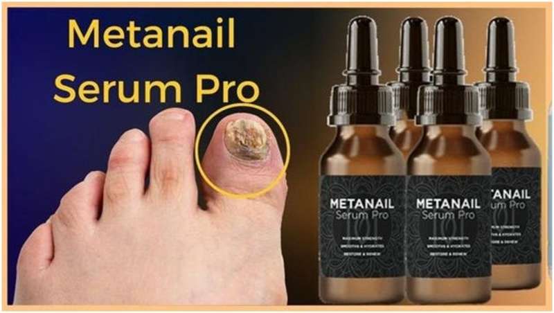 Cover image for Introducing Metanail Serum Pro: Revolutionizing Nail Care