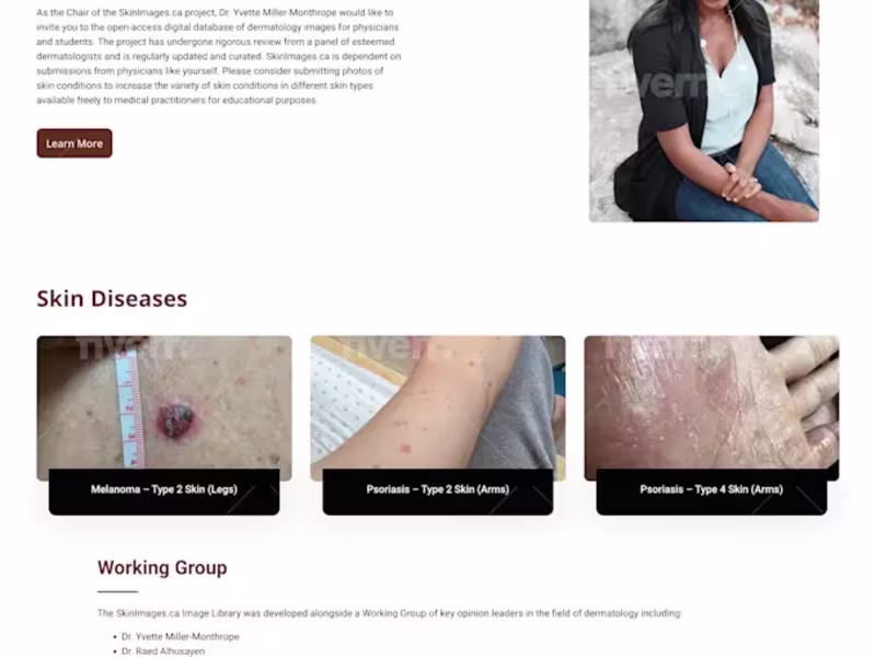 Cover image for I will build website design and redesign Wordpress website