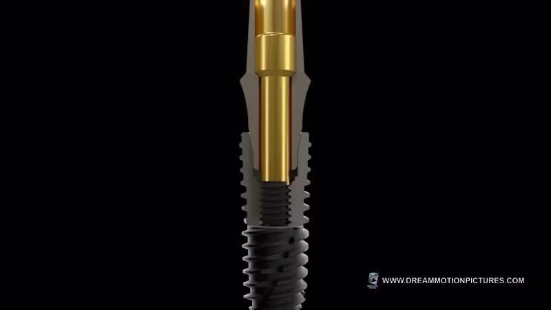 Cover image for Innovative Dental Implant Material Animation