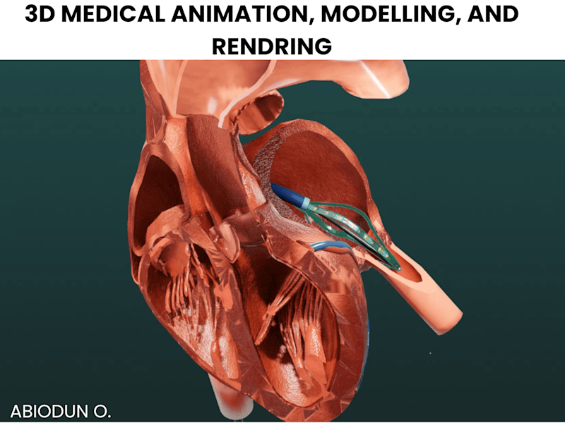 Cover image for I will do 3D Medical animation, 3D Modelling, and 3d Rendering