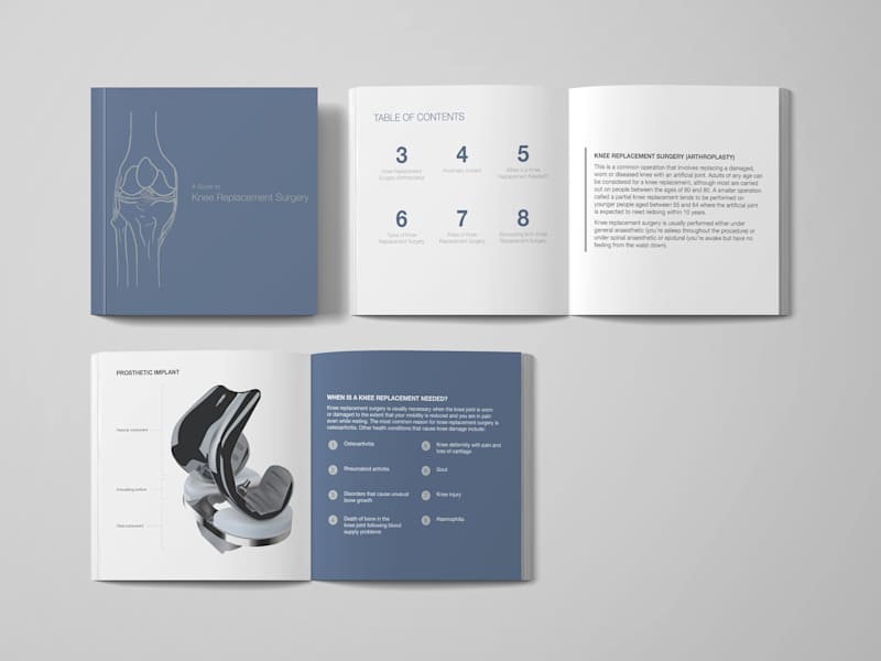 Cover image for Knee Replacement Book Design
