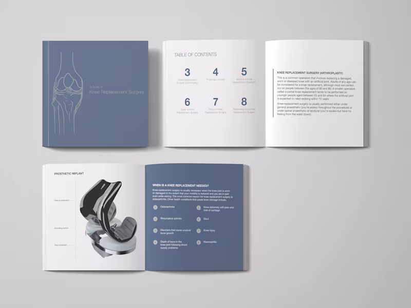 Cover image for Knee Replacement Book Design