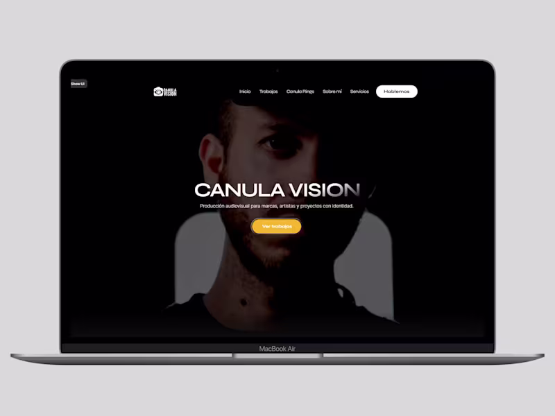 Cover image for Canula Vision Website:
Design and development