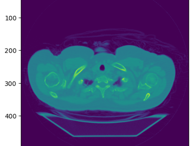 Cover image for Biomedical Image Analysis
