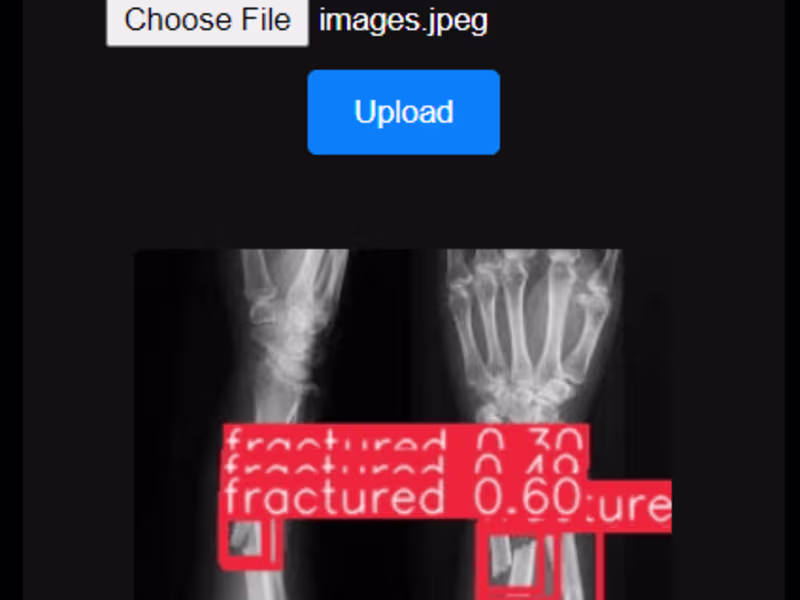 Cover image for Fracture Detection