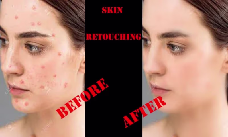 Cover image for I will do high end photo retouching, skin retouching