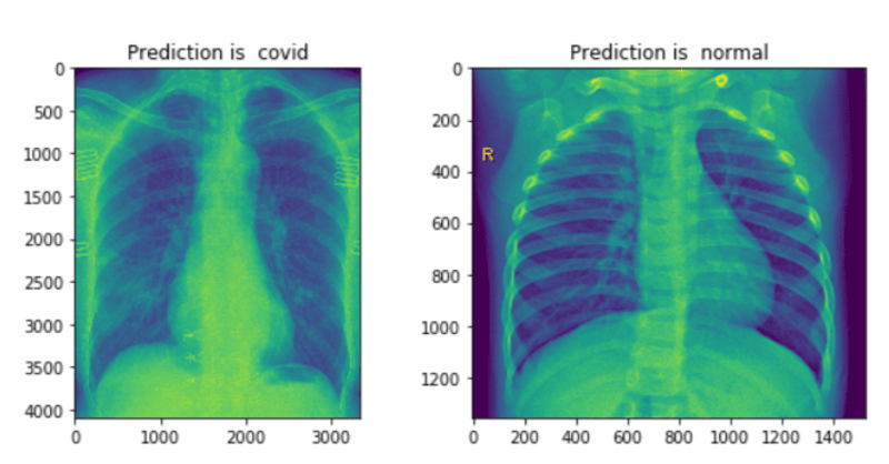 Cover image for Iamarman79/COVID-19-Deep-Learning-CNN-Model