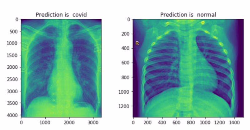 Cover image for Iamarman79/COVID-19-Deep-Learning-CNN-Model