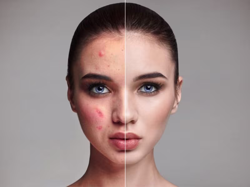 Cover image for Photo retouching & enhance