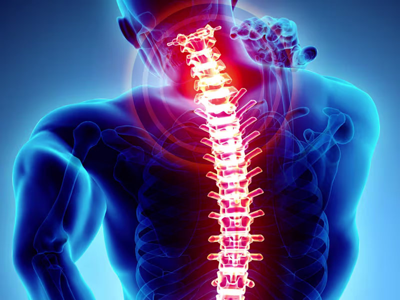 Cover image for Chiropractic Care Comprehensive Overview