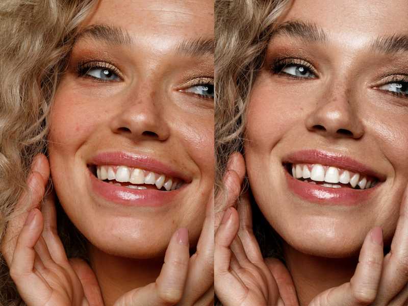 Cover image for Beauty Retouch 