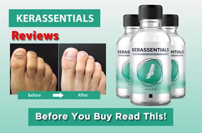 Cover image for Kerassentials – (Pros and Cons) Is It Scam Or Legit?