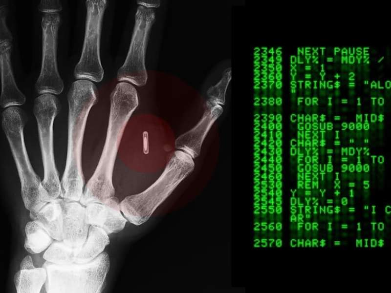 Cover image for Microchipping Employees is a No-good, Horrible and Terrible Idea