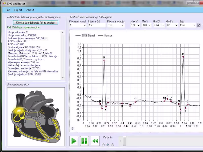 Cover image for EKG analyzer