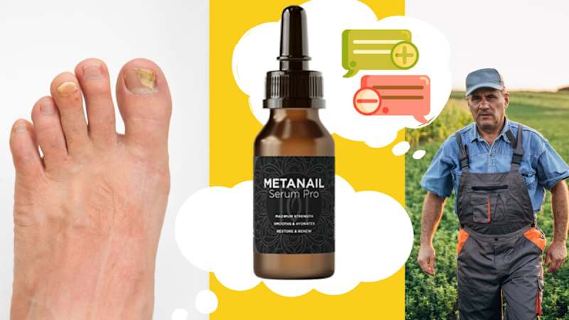 Cover image for Say Goodbye to Nail Fungus with Metanail Serum Pro!