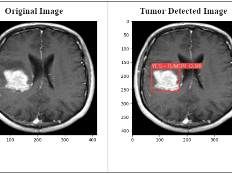 Cover image for Advanced Brain Tumor Detection & Segmentation