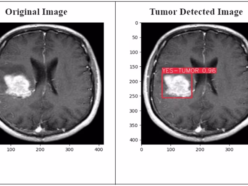 Cover image for Advanced Brain Tumor Detection & Segmentation