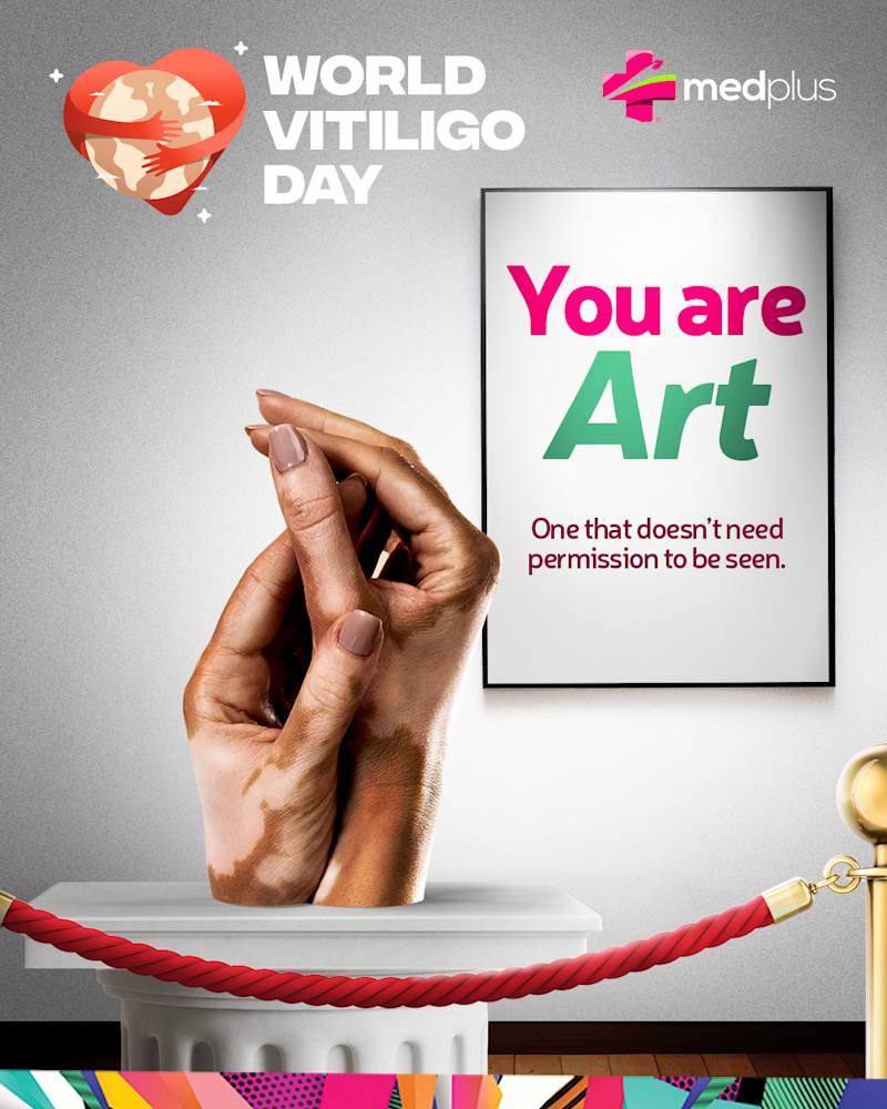 Cover image for Vitiligo: Art in Diversity
