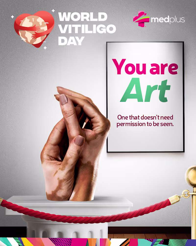 Cover image for Vitiligo: Art in Diversity