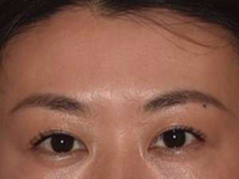 Cover image for Transforming Textured Skin to Glass Skin