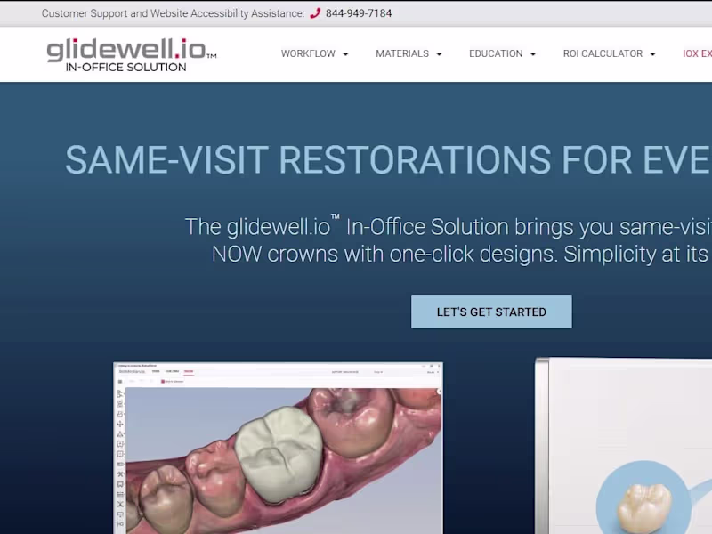 Cover image for Glidewell.io | Same-Visit Dentistry | CAD CAM System