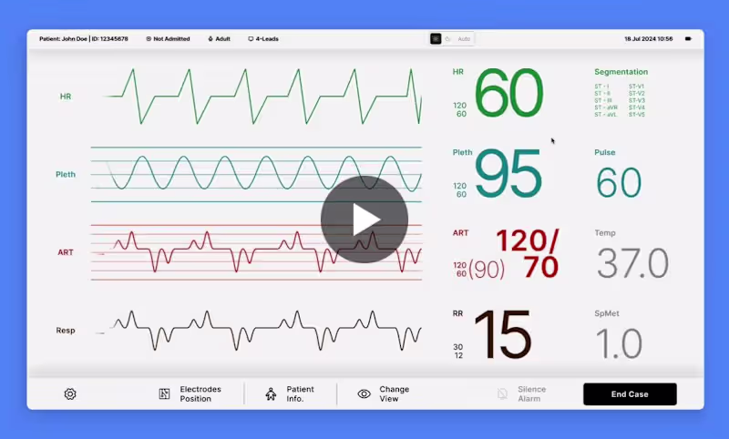 Cover image for ECG Monitor design