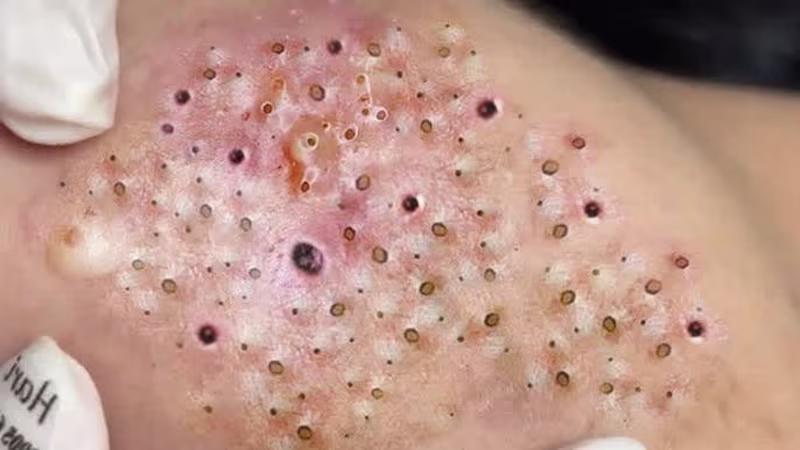 Cover image for MLNIN: E-commerce & Mobile App Design + Product Development