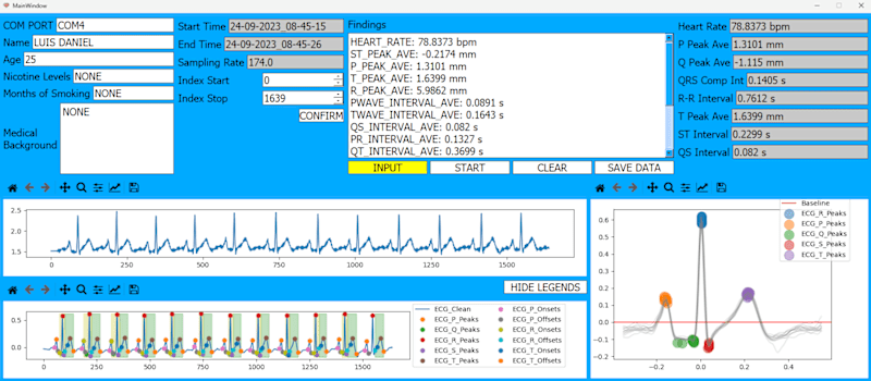 Cover image for Real-Time Detection and Classification of Heart Arrhythmia