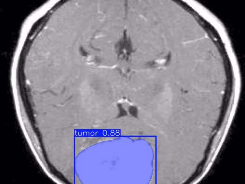 Cover image for Analysis of images and videos with AI