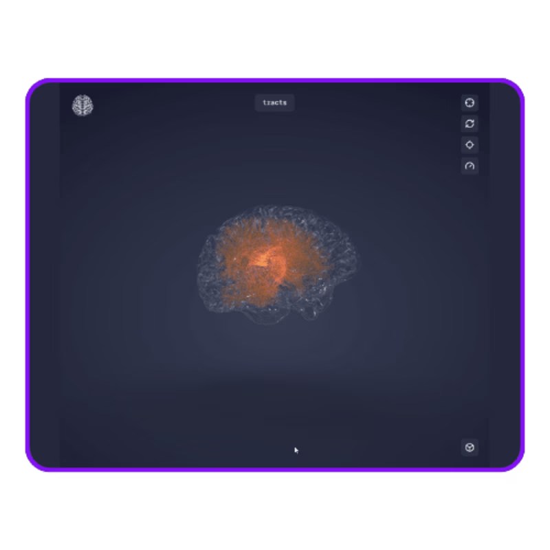 Cover image for 3D Brain Animations | Web app
