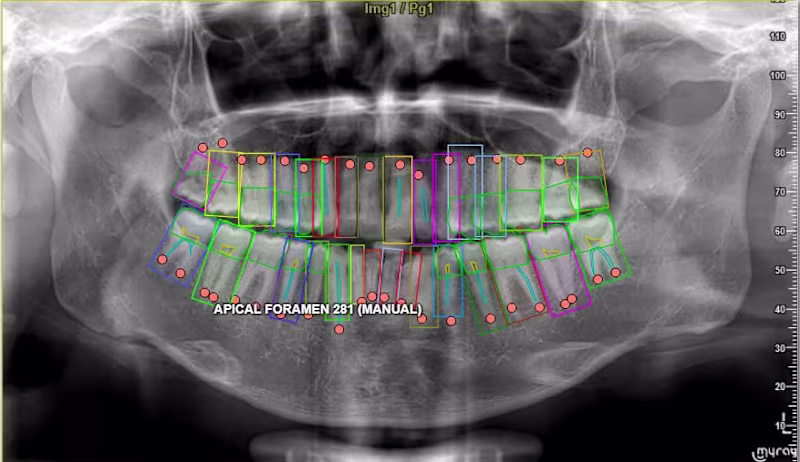Cover image for Annotated complex dental X-ray medical