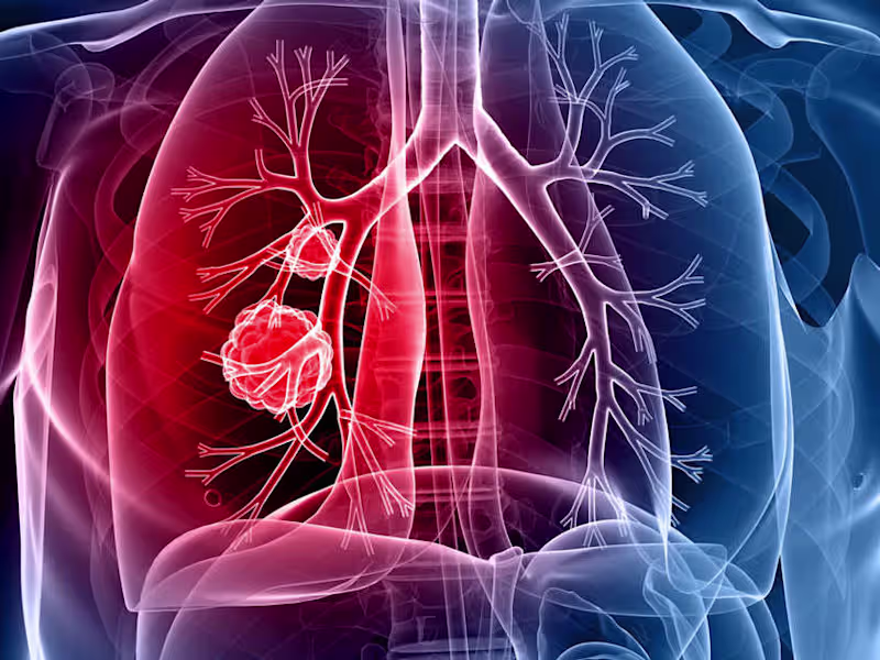 Cover image for samrat0033/Lung_Cancer_Prediction