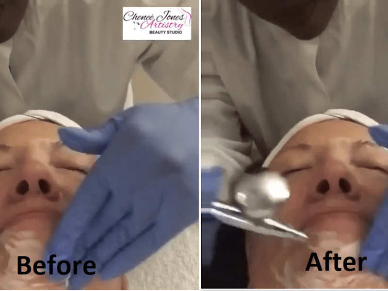 Cover image for Logo/Watermark Removal From Video